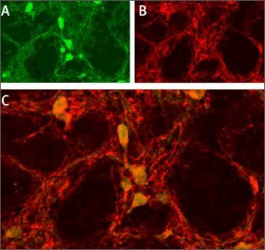 Anti-Sodium Channel ASIC1 antibody produced in rabbit affinity isolated antibody, lyophilized powder