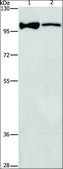 Anti-ADCY3 antibody produced in rabbit affinity isolated antibody