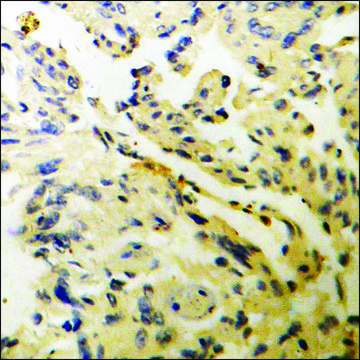 Anti-phospho-WNK1 (pThr58) antibody produced in rabbit affinity isolated antibody