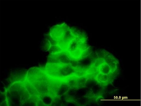 Anti-CALCR antibody produced in mouse purified immunoglobulin, buffered aqueous solution