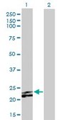 Anti-FGF23 antibody produced in mouse purified immunoglobulin, buffered aqueous solution