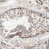 Anti-CAMK1D antibody produced in rabbit Prestige Antibodies&#174; Powered by Atlas Antibodies, affinity isolated antibody, buffered aqueous glycerol solution