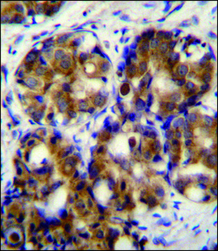 ANTI-HMMR (C-TERM) antibody produced in rabbit IgG fraction of antiserum, buffered aqueous solution