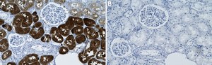 Anti-PSAT1 Antibody, clone 1C7 ZooMAb&#174; Rabbit Monoclonal recombinant, expressed in HEK 293 cells