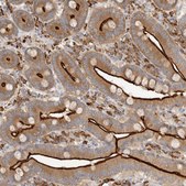 Anti-USH1C antibody produced in rabbit Prestige Antibodies&#174; Powered by Atlas Antibodies, affinity isolated antibody, buffered aqueous glycerol solution, ab1