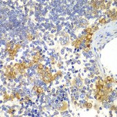 Anti-NOTCH1 antibody produced in rabbit