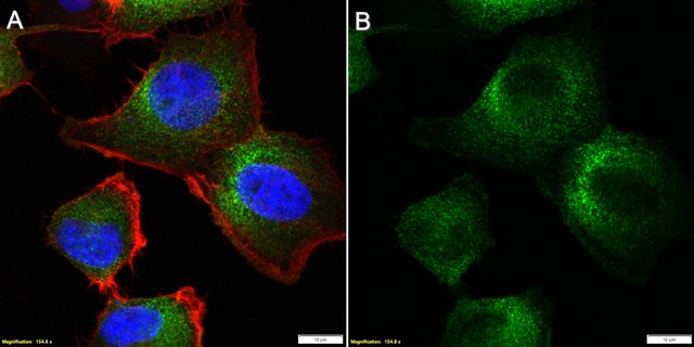 Anti-Piezo1 Antibody, clone 2B18 ZooMAb&#174; Rabbit Monoclonal recombinant, expressed in HEK 293 cells