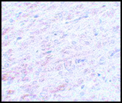 Anti-TCF3 antibody produced in rabbit affinity isolated antibody, buffered aqueous solution