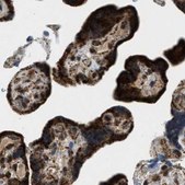 Anti-HIBADH antibody produced in rabbit Prestige Antibodies&#174; Powered by Atlas Antibodies, affinity isolated antibody, buffered aqueous glycerol solution, Ab2