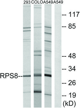 Anti-RPS8 antibody produced in rabbit affinity isolated antibody