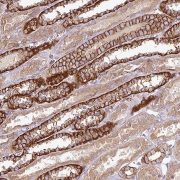 Anti-RIC1 antibody produced in rabbit Prestige Antibodies&#174; Powered by Atlas Antibodies, affinity isolated antibody, buffered aqueous glycerol solution