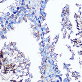 Anti-Annexin A2 antibody produced in rabbit