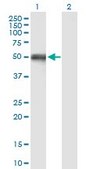 Anti-OXCT1 antibody produced in mouse purified immunoglobulin, buffered aqueous solution