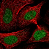 Anti-SMC3 antibody produced in rabbit Prestige Antibodies&#174; Powered by Atlas Antibodies, affinity isolated antibody