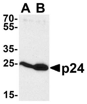 Anti-HIV-1 p24 antibody produced in rabbit affinity isolated antibody