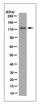 Anti-CDKL5 Antibody, clone 8F3.1 clone 8F3.1, from mouse