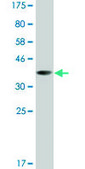 Monoclonal Anti-LHX5 antibody produced in mouse clone 1D9, ascites fluid