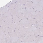 Anti-TOX2 antibody produced in rabbit Prestige Antibodies&#174; Powered by Atlas Antibodies, affinity isolated antibody, buffered aqueous glycerol solution