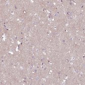 Anti-COL8A1 antibody produced in rabbit Prestige Antibodies&#174; Powered by Atlas Antibodies, affinity isolated antibody, buffered aqueous glycerol solution