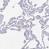Anti-FCGR3A antibody produced in rabbit Prestige Antibodies&#174; Powered by Atlas Antibodies, affinity isolated antibody, buffered aqueous glycerol solution