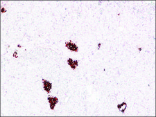 Monoclonal Anti-Insulin antibody produced in mouse clone K36AC10, ascites fluid