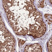 Anti-ZBTB5 antibody produced in rabbit Prestige Antibodies&#174; Powered by Atlas Antibodies, affinity isolated antibody, buffered aqueous glycerol solution