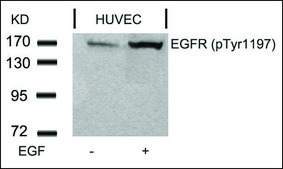 Anti-phospho-EGFR (pTyr1197) antibody produced in rabbit affinity isolated antibody