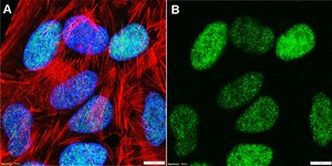 Anti-CBX5 Antibody, clone 5I2-K ZooMAb&#174; Rabbit Monoclonal recombinant, expressed in HEK 293 cells