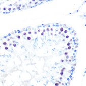 Anti-HDAC9 Antibody, clone 3L5E5, Rabbit Monoclonal