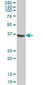 Anti-ALDOB antibody produced in mouse purified immunoglobulin, buffered aqueous solution