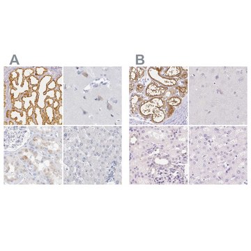 Anti-CSN1S1 antibody produced in rabbit Prestige Antibodies&#174; Powered by Atlas Antibodies, affinity isolated antibody, buffered aqueous glycerol solution