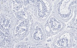 Anti-EZHIP/CXorf67 Antibody, clone 1J8 ZooMAb&#174; Rabbit Monoclonal recombinant, expressed in HEK 293 cells