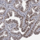 Anti-POLD2 antibody produced in rabbit Prestige Antibodies&#174; Powered by Atlas Antibodies, affinity isolated antibody, buffered aqueous glycerol solution