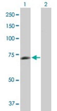 Anti-PGM2L1 antibody produced in mouse purified immunoglobulin, buffered aqueous solution