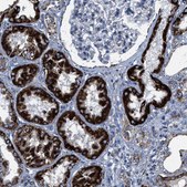 Anti-ALDH1B1 antibody produced in rabbit Prestige Antibodies&#174; Powered by Atlas Antibodies, affinity isolated antibody, buffered aqueous glycerol solution
