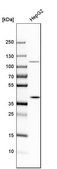 Anti-MAT2B antibody produced in rabbit Prestige Antibodies&#174; Powered by Atlas Antibodies, affinity isolated antibody, buffered aqueous glycerol solution