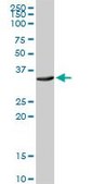 Anti-ATP1B3 antibody produced in rabbit purified immunoglobulin, buffered aqueous solution