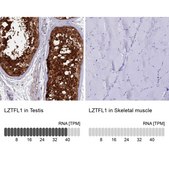 Anti-LZTFL1 antibody produced in rabbit Prestige Antibodies&#174; Powered by Atlas Antibodies, affinity isolated antibody, buffered aqueous glycerol solution