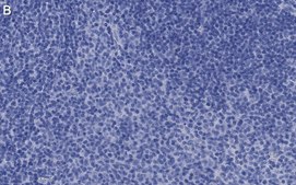 Anti-CD25 (IL2-RA) Antibody, clone 1K6 ZooMAb&#174; Rabbit Monoclonal recombinant, expressed in HEK 293 cells