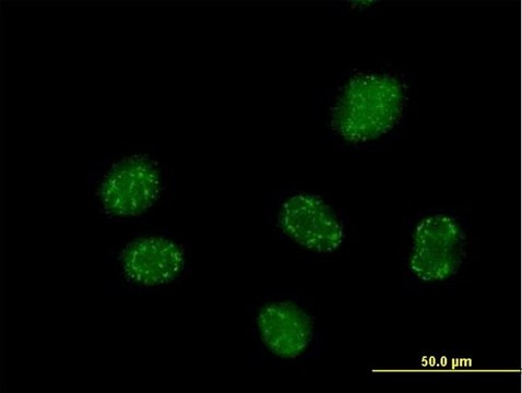 Anti-ELAC1 antibody produced in mouse purified immunoglobulin, buffered aqueous solution