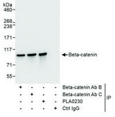 Rabbit anti-Beta-catenin Antibody, Affinity Purified Powered by Bethyl Laboratories, Inc.