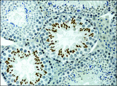 Anti-acetyl-Histone H3 (Ac-Lys9) antibody produced in rabbit 2-2.5&#160;mg/mL, affinity isolated antibody, buffered aqueous solution