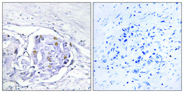 Anti-Progesterone Receptor antibody produced in rabbit affinity isolated antibody