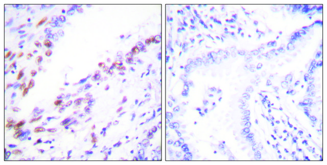 Anti-KI67 antibody produced in rabbit affinity isolated antibody