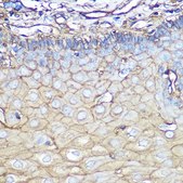 Anti-Annexin A2 antibody produced in rabbit