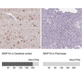 Anti-MAP1A antibody produced in rabbit Prestige Antibodies&#174; Powered by Atlas Antibodies, affinity isolated antibody, buffered aqueous glycerol solution