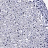 Anti-NACAD antibody produced in rabbit Prestige Antibodies&#174; Powered by Atlas Antibodies, affinity isolated antibody, buffered aqueous glycerol solution