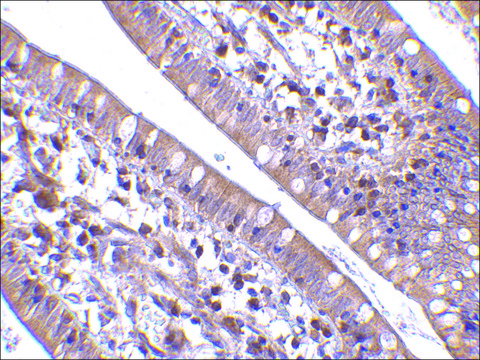 Anti-CIDE-B (ab2) antibody produced in rabbit affinity isolated antibody, buffered aqueous solution