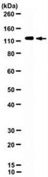 Anti-Cadherin 6 Antibody, clone 2B6-D8