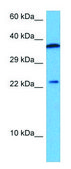 Anti-Grem1 antibody produced in rabbit affinity isolated antibody